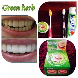 Kem trắng răng xanh Green Herb (Herbal toothpaste)